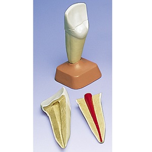 UPPER INCISOR 2-PART